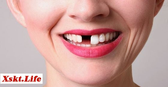 Mơ thấy rụng một chiếc răng – Chiêm bao thấy rụng một chiếc răng đánh con gì?